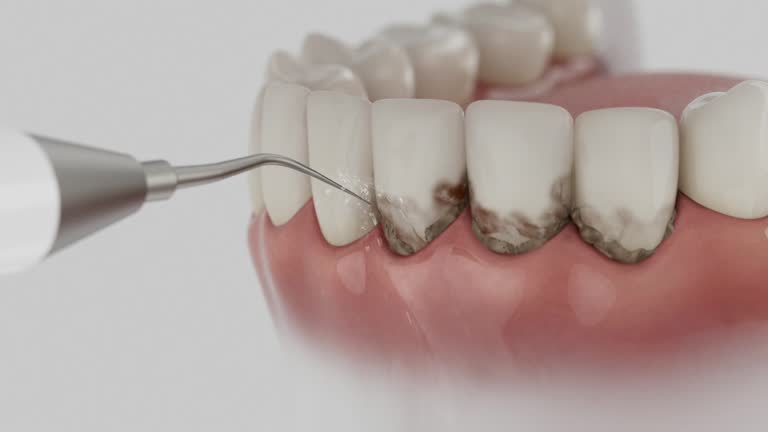 Reliable Emergency Dentist contractor in Concord, MO by Smile Center Dentistry
